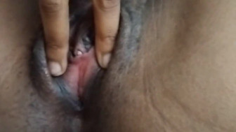 Vagina
